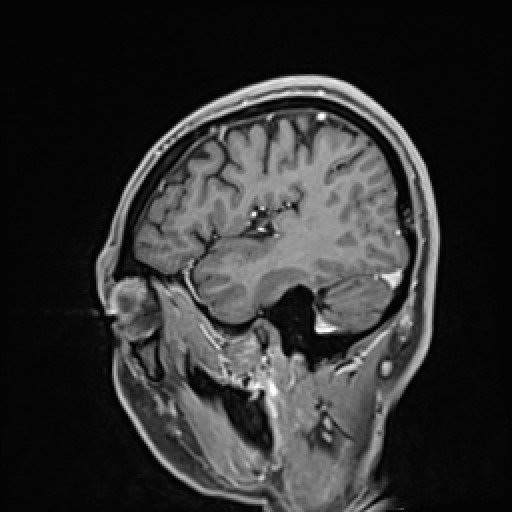 Click on the Serie image to view the images of VILLANUEVA, WILLIAM A.